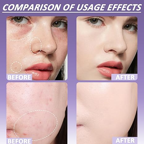 đ„ Sommarrea đ„ Mjuk matt krĂ€mconcealer
